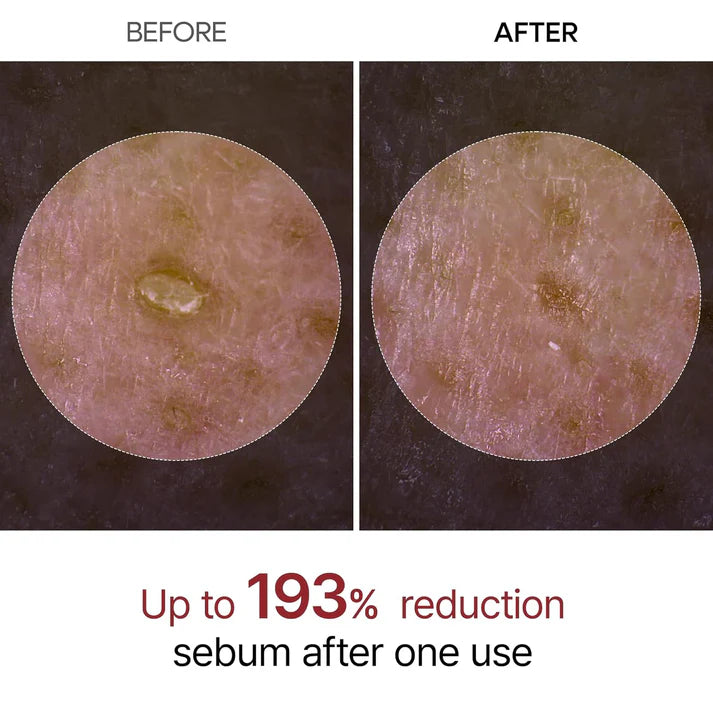 Radiant Glow Rice Exfoliating Serum™