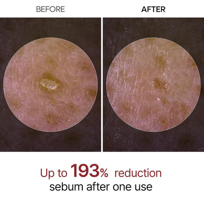 Radiant Glow Rice Exfoliating Serum™